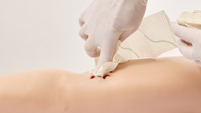 The wound dressing Speed M professionally inserted into a plastic wound as a demonstration.